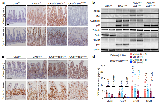 Nature：The gut microbiome switches mutant p53 from tumour-suppressive to oncogenic肠道微生物组将突变体p53从抑制肿瘤转变为致癌