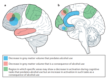 BMJ：敏感时期饮酒可能会使大脑神经遭受毒性害
